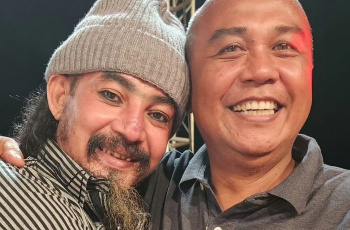 Limbad Alami Luka Bakar 8 Persen di Wajah, Dokter Khawatirkan Ini
