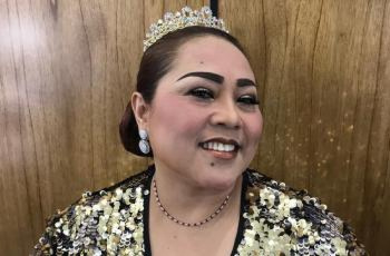 Lepas Dari Belenggu Kanker, Nunung Bagikan Semangat Lawan Penyakit Kanker