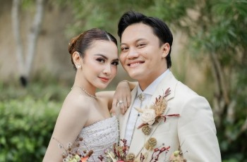 Sule Ungkap Alasan Rizky Febian Oplas Hidung, Bukan Demi Penampilan