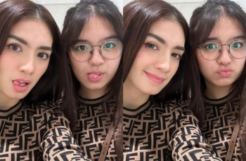 Angel Karamoy Curhat Efek Oplas, Netizen Kompak Menyayangkan: Cantikan Sebelum Operasi