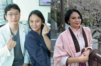 Dian Nitami Lakukan Operasi Facelift di Usia 53 Tahun, Punya Keinginan Sejak Umur 40