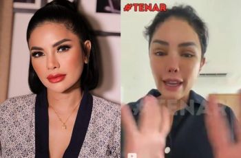 Nikita Mirzani Muncul usai Oplas Wajah, Auto Dikomentari: Lubang Hidungnya Kok Gitu?