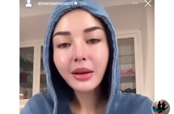 Alami Perubahan Drastis, Hasil Diduga Oplas Wajah Amanda Manopo Bikin Takut: Mukanya Seram