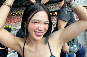 Bantah Tanda Merah di Leher karena  Dicupang, Wika Salim Ternyata Habis Begini