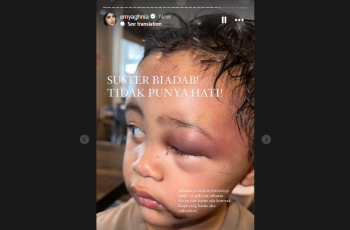 Emy Aghnia Dapati Anak Perempuannya Jadi Korban Keganasan Babysitternya