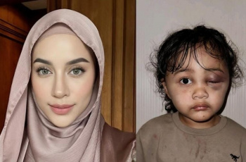 Terungkap! Tampang Sadis Suster yang Lakukan Penganiayaan ke Anak Selebgram Aghnia Punjabi hingga Babak Belur