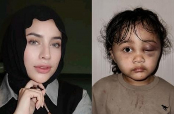 Aghnia Punjabi Sempat Tinggalkan Anaknya Selama 2 Hari Sebelum Akhirnya Dianiaya oleh Suster