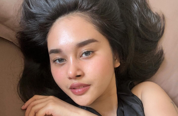 Dhyaz Permesta kembali lakukan operasi [Instagram @permestadhyaz]