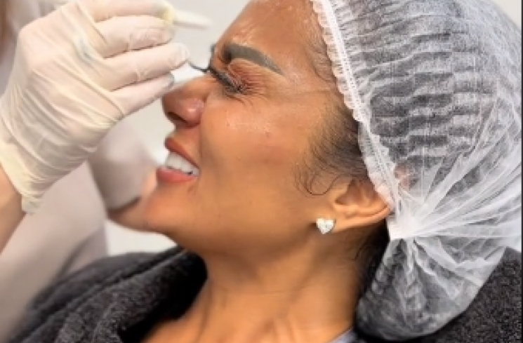 Video Krisdayanti saat melakukan botox di bagian wajahnya. (tangkapan layar/TikTok) [TikTok.]