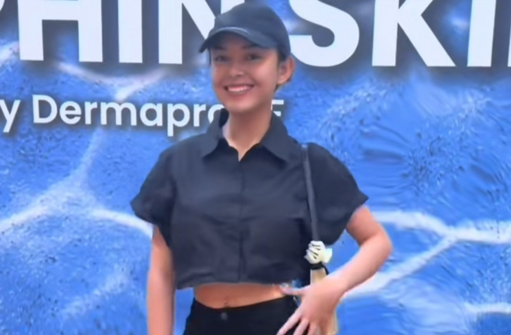 Amanda Manopo [Tiktok/@dermaprosf]
