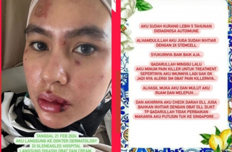 Klarifikasi Kartika Putri [Instagram @lambe_turah]