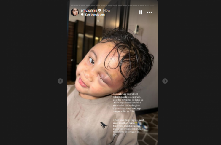 unggahan Emy tentang anaknya yang mendapatkan kekerasan [Instagram.com]