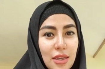 Bus Angkut WNI Kecelakaan di Turki, Cinta Penelope Mohon Doa