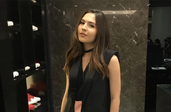 Terbakar Parah, Kulit Olivia Jensen Jadi Kayak Kepiting Rebus