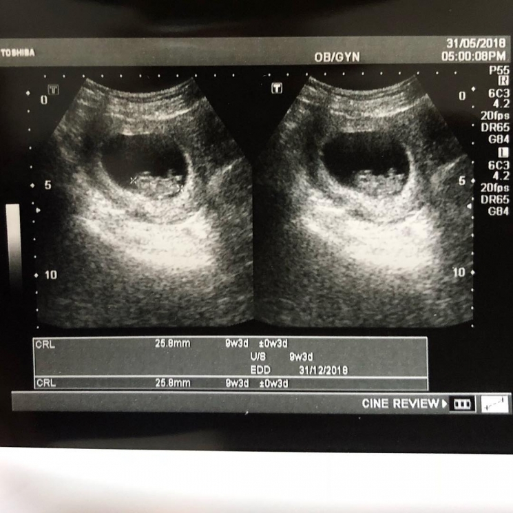 Postingan Desta di Instagramnya