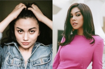 10 Artis Ini Disulap Jadi Plontos Bak Ronaldowati, Masih Cantik?