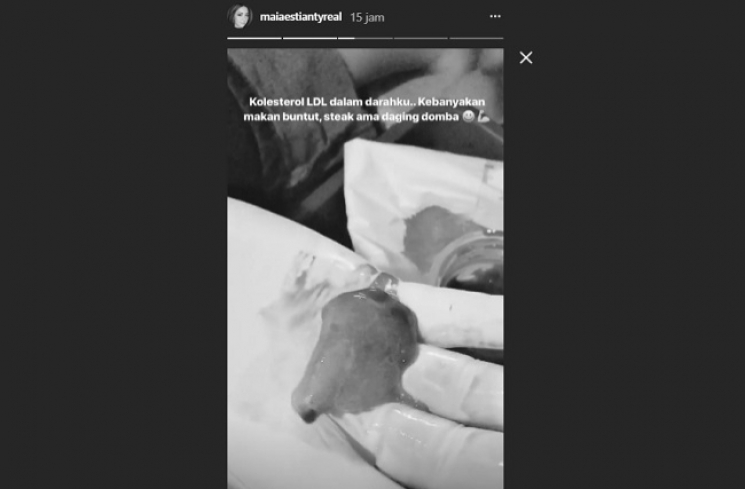 Maia Estianty saat jalani terapi Alfashdu/  Instagram Story @maiaestiantyreal