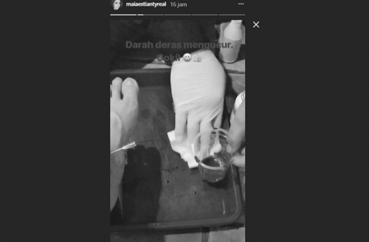 Maia Estianty saat jalani terapi Alfashdu/  Instagram Story @maiaestiantyreal