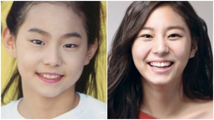 Uee After School