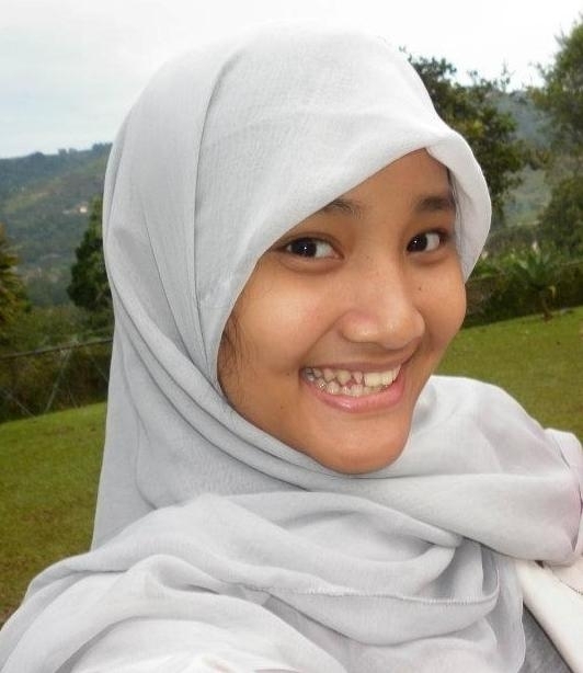 Perubahan Fatin Shidqia/ Istimewa