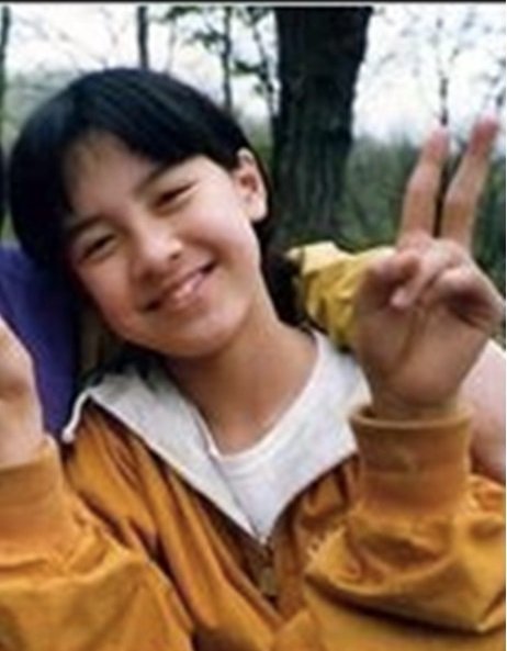Song Ji Hyo (plastytalk.com)