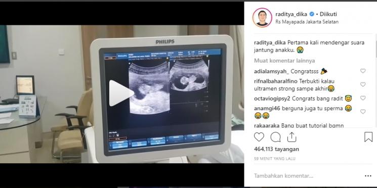 Raditya Dika pertama kali dengar detak jantung anaknya (Instagram/@raditya_dika)
