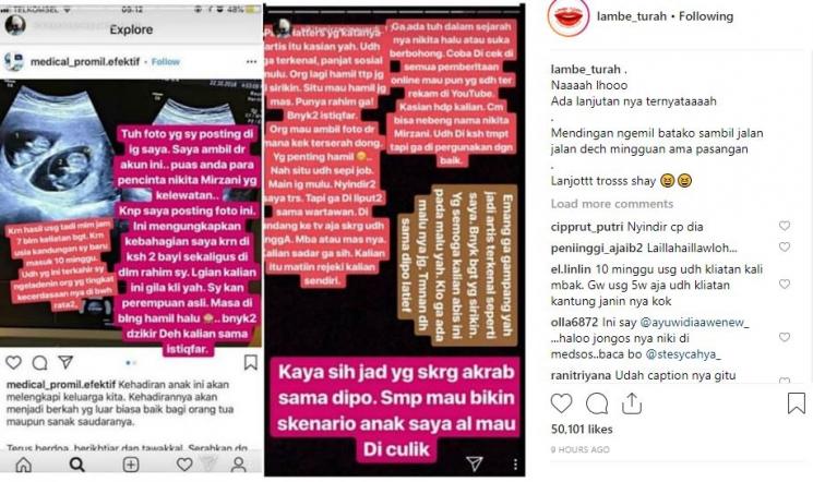 USG yang diposting Nikita Mirzani. (Instagram/@lambe_turah)