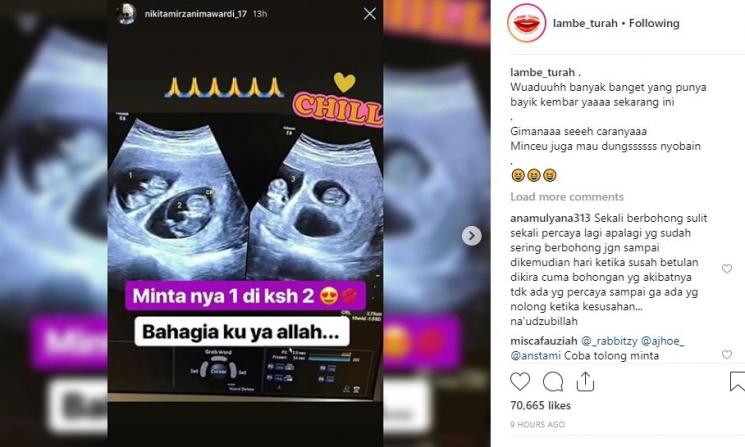 USG yang diposting Nikita Mirzani. (Instagram/@lambe_turah)