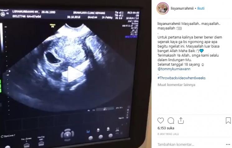Postingan istri Tommy Kurniawan. (Instagram/@lisyanurrahmii)
