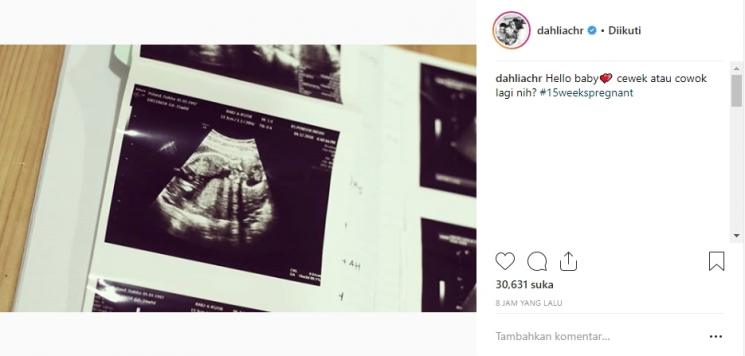 Dahlia Poland hamil anak kedua. (Instagram/@dahliachr)