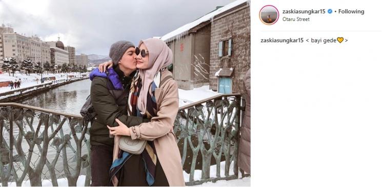 Irwansyah dan Zaskia Sungkar. (Instagram/@zaskiasungkar15)