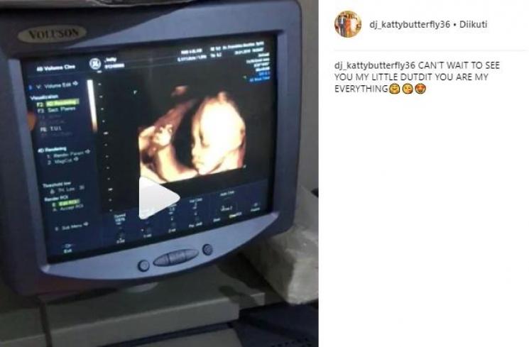 Hasil USG kehamilan DJ Katty Butterfly. (Instagram/@dj_kattybutterfly36)