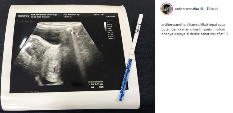 Istri Ardit Erwanda hamil. (Instagram/@arditerwandha)