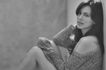 Beredar Foto Rontgen Wajah Sophia Latjuba: Tengkoraknya Aja Cantik