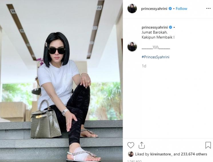 Syahrini mengunggah foto dengan kaki diperban. (Instagram/@princessyahrini)