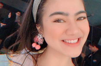 Kini Sukses dan Populer, 3 Artis Cantik Ini Ternyata Pernah Jadi Korban Bully