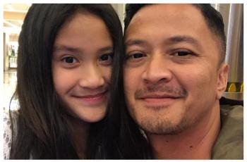 5 Potret Cantik Harliafa Princi Maryadi, Putri Sambung Deswita Maharani