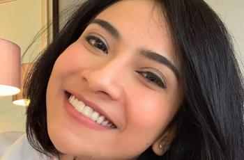Trauma, Vanessa Angel Kini Deg-degan Jika Mau ke Surabaya