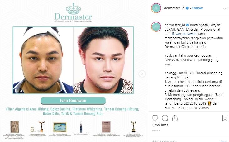 Ivan Gunawan. (Instagram/@dermaster_id)