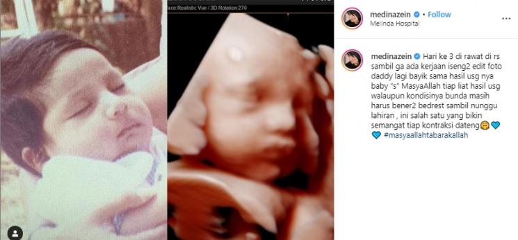 Anak Medina Zein dan Lukman Azhari (Instagram/@medinazein)