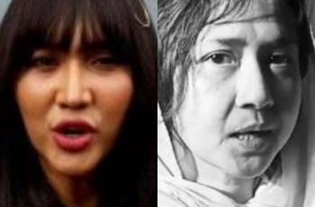 Bokong Artis Diremas, Suami Beberkan Kondisi Istri