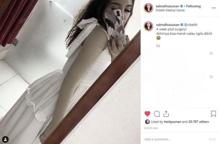 Salmafina Sunan usai sedot lemak (Instagram @salmafinasunan)