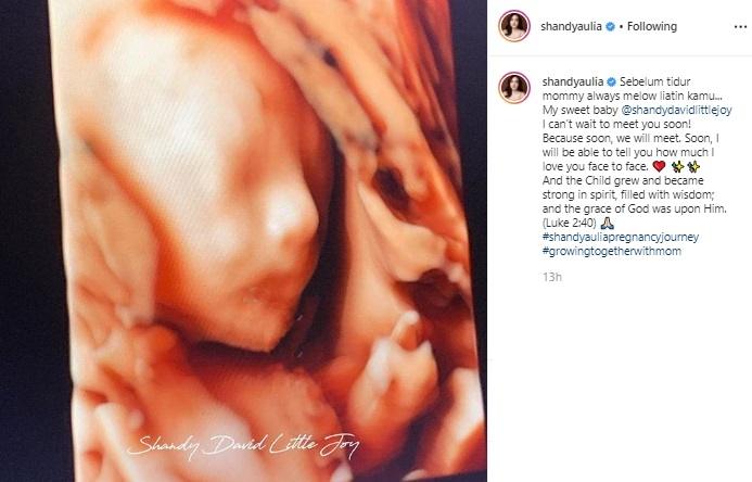 Jabang Bayi Shandy Aulia. (Instagram/@shandyaulia)