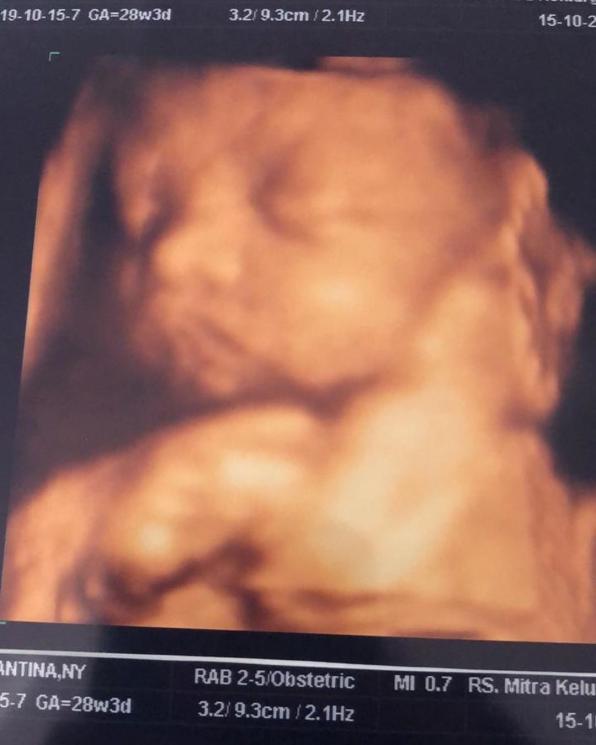 Foto USG bayi rapper Young Lex di Instagram.