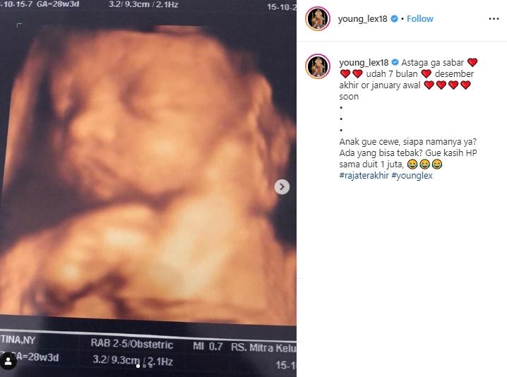 Foto hasil USG calon anak Young Lex (Instagram/@young_lex18)