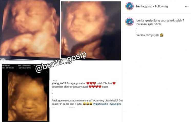 Young Lex (Instagram/@berita_gosip)