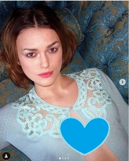 Keira Knightley dengan Kulit Berjerawat. (Instagram/@keiraknlghtley)