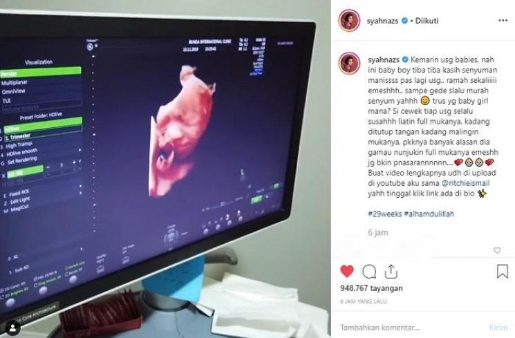 Foto USG bayi Syahnaz Sadiqah (Instagram @syahnazs)