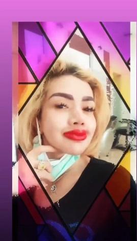 Penampilan Barbie Kumalasari usai sulam bibir. [capture Instagram]