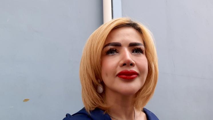 Barbie Kumalasari tunjukkan bibir jontor 5 cm usai sulam bibir. [MataMata.com/Evi Ariska]